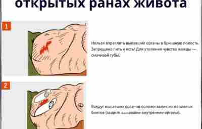 🟩 Помощь при открытых ранах живота Открытые повреждения живота являются следствием колото-резаных, осколочных или…