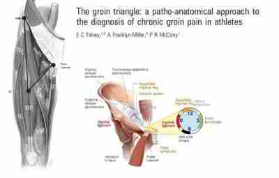 Боль в паху / Groin pain Боль в паху является чрезвычайно распространенным явлением в…