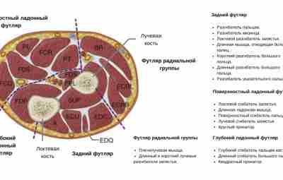 Синдром перекреста Синдром перекреста (от англ. intersection syndrome) — это состояние, при котором поражаются…