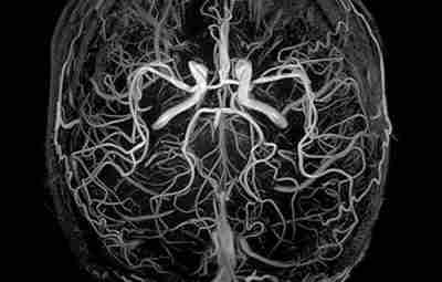 МР ангиография сосудов головного мозга. Это высокоинформативный и безопасный метод обследования, который позволяет визуализировать…