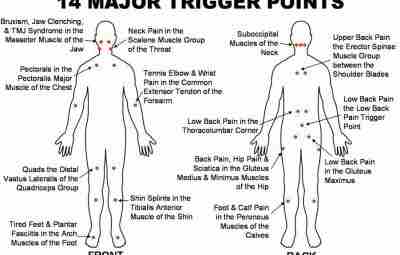 АКТИВНЫЕ И ЛАТЕНТНЫЕ ТРИГГЕРНЫЕ ТОЧКИ Пусковым моментом возникновения триггерной точки может стать перенапряжение мышцы…