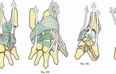 Двигательные мышцы лучезапястного сустава На рис. 134 (лучезапястный сустав, вид спереди) можно видеть следующие…