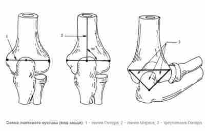 Треугольник и линия Гютера Нормальному локтевому суставу соответствует определенное соотношение трех опознавательных костных выступов…