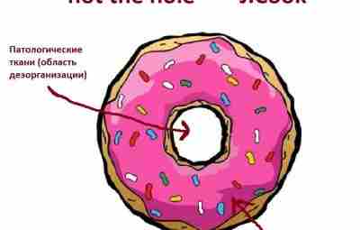 Treat the doughnut, not the hole. — , S. Docking et al. (2014) впервые…