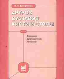 Артроз суставов кисти и стопы — Епифанов В.А. — Клиника, диагностика, лечение Описание: Монография…