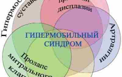 ПРИНЦИПЫ РЕАБИЛИТАЦИИ БОЛЬНЫХ С ДИСПЛАЗИЕЙ СОЕДИНИТЕЛЬНОЙ ТКАНИ. Важным условием эффективной реабилитации пациентов с различными…