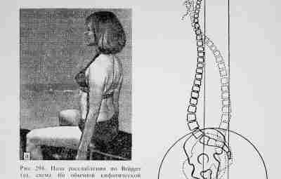 РАЗГРУЗОЧНАЯ ПОЗА BRIIGGER. В многочисленных публикациях Briigger предостерегает от вредного воздействия кифоза, при котором,…