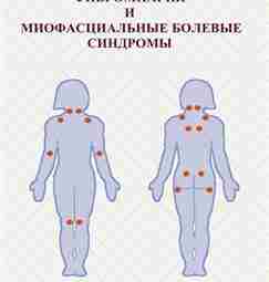 Тузлуков А.П., Горбатовская Н.С. Фибромиалгия и миофасциальный болевой синдром Монография. — Пенза: Профессионал, 2008….