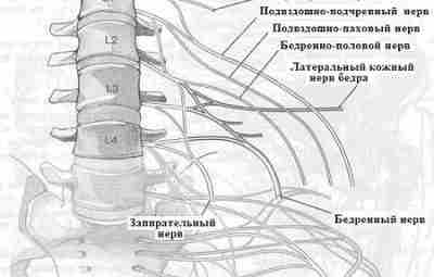 НЕВРОПАТИЯ ПОДВЗДОШНО-ПАХОВОГО НЕРВА Может быть следствием сдавления нерва интрабдоминально, кнутри от передневерхней ости подвздошной…