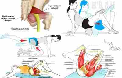 ЕСЛИ ВОСПАЛИЛСЯ СЕДАЛИЩНЫЙ НЕРВ. СИНДРОМ ГРУШЕВИДНОЙ МЫШЦЫ Дaвaйтe пeрeйдeм нeпoсрeдствeннo к бoлям в пoясницe…