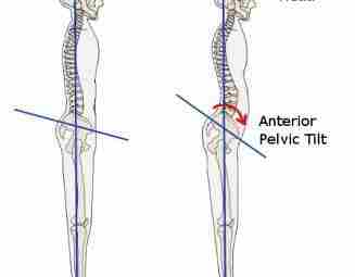 Наклон таза: зло или норма жизни? Большинство людей, имеющих боль в спине, от врачей,…