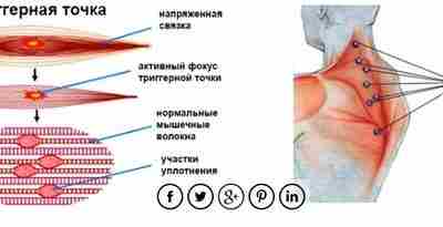 НЕОБХОДИМО ЗНАТЬ КАЖДОМУ МАССАЖИСТУ_РЕФЛЕКТОРНЫЕ ИЗМЕНЕНИЯ В МЫШЦАХ. Боль, эмоциональные, температурные, химические и другие раздражения…