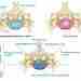 ЕЩЕ РАЗ О ДИСКОГЕННЫХ ВЕРТЕБРАЛЬНЫХ НАРУШЕНИЯХ В позвоночном канале выпавший диск может быть расположен…