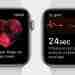 Теперь с помощью Apple Watch можно делать ЭКГ. Но нужно ли это делать? #кардиология…