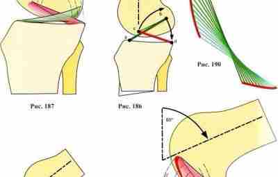 Механическая роль крестообразных связок коленного сустава Обычно крестообразные связки изображают в виде линейных тяжей…