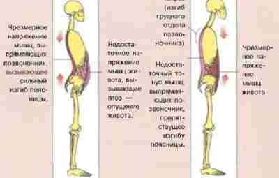 ОСАНКА: АБДОМИАЛЬНО-ПОЯСНИЧНОЕ СООТНОШЕНИЕ В работе над осанкой очень важно равномерно разрабатывать мышцы как брюшного…