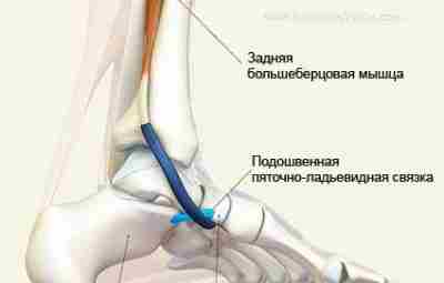 Тендинит сухожилия задней большеберцовой мышцы Так как мы постоянно нагружаем ноги, мышцам приходится выполнять…