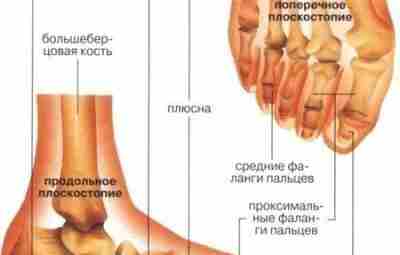 КОМПЛЕКС УПРАЖНЕНИЙ ДЛЯ ЛЕЧЕНИЯ ПЛОСКОСТОПИЯ. Несмотря на свою кажущуюся безобидность, плоскостопие является весьма неприятной…