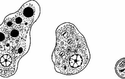 Как лечить паразитарные заболевания, вызванные простейшими? Спойлер: пейте только кипяченную воду, и не забывайте,что…