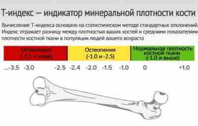 3 способа укрепления костей Крепкие кости — фундамент здорового и спортивного тела, готового к…