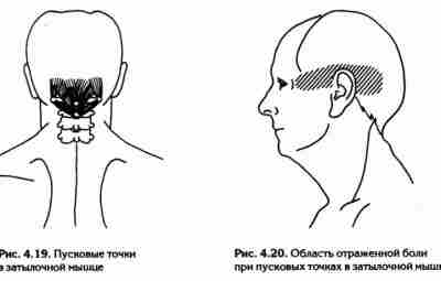 ЗАТЫЛОЧНЫЕ МЫШЦЫ: ТРИГГЕРНЫЕ ТОЧКИ, СИМПТОМЫ, ПРИЧИНЫ, ЛЕЧЕНИЕ Затылочные мышцы расположены сразу под основанием черепа….