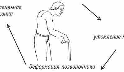 ХРОНИЧЕСКИЙ МЫШЕЧНЫЙ СПАЗМ – ПРИЧИНА БОЛЕЙ В СПИНЕ Чем же плоха неправильная осанка? Прежде…