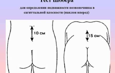 Тест Шобера Тест Шобера используется для определения уменьшения амплитуды сгибания поясничного отдела позвоночника, что…