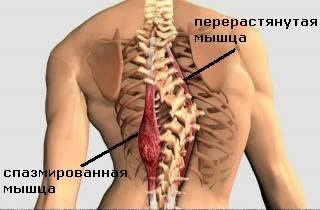 ПОСТУРАЛЬНЫЙ МЫШЕЧНЫЙ ДИСБАЛАНС НА ФОНЕ ПАТОЛОГИИ СКЕЛЕТНО-МЫШЕЧНОЙ И НЕРВНОЙ СИСТЕМЫ ЗАКОН КОНТРАКТУРЫ Академик Н.А….
