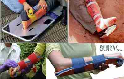 Как применять шины SAM Splint (и нужны ли вам именно они) Шины из алюминиевых…
