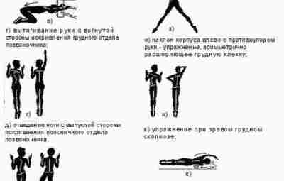 УПРАЖНЕНИЯ ПРИ СКОЛИОЗЕ ПО А.Ф. КАПТЕЛИНУ Основным средством лечебной физкультуры при сколиозе является лечебная…